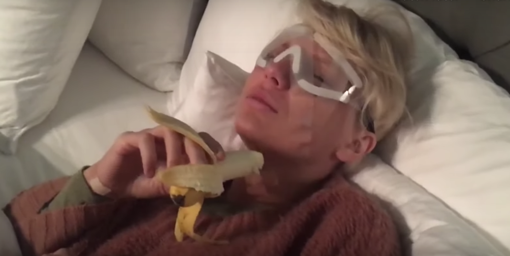 Taylor Swift banana video after lasik surgery