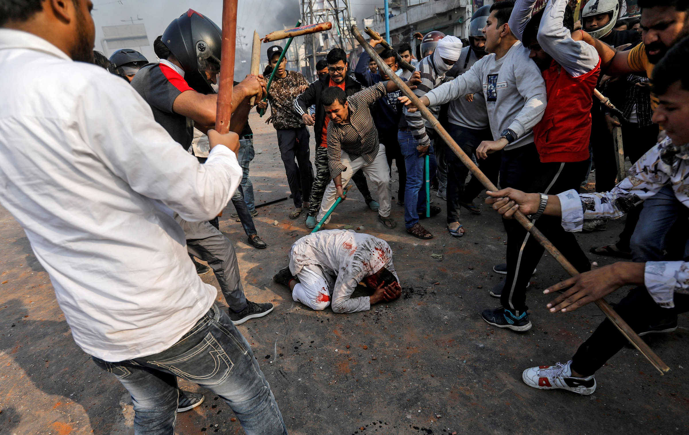 Mohammad Zubair, musulmán de 37 años, fue golpeado por un grupo de hindúes el 24 de febrero | Siddiqui Danés / Reuters