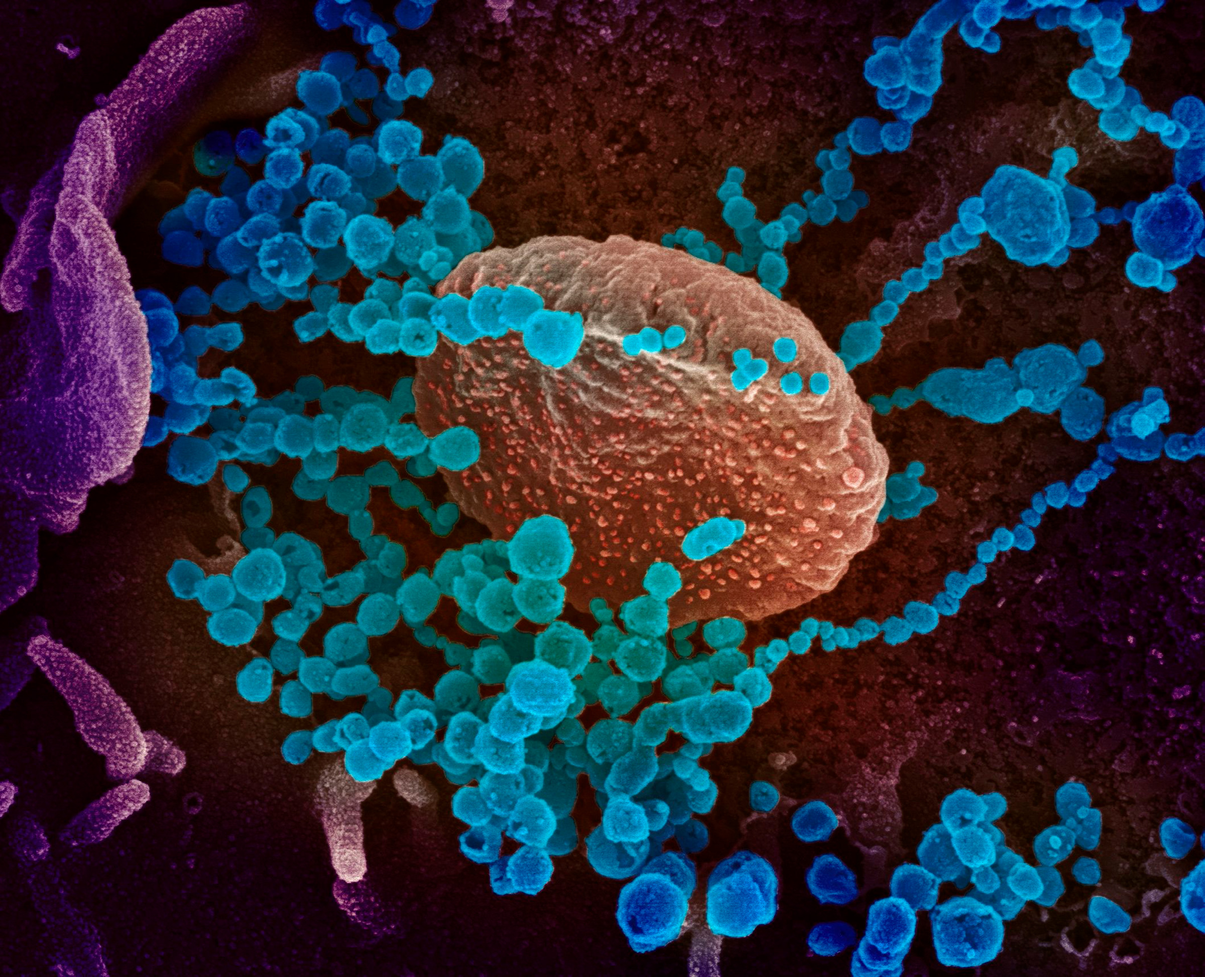 This image obtained on March 12 shows a scanning electron microscope image of SARS-CoV-2 (round blue objects) emerging from the surface of cells cultured in the lab, SARS-CoV-2, also known as 2019-nCoV, is the virus that causes COVID-19, the virus shown was isolated from a patient in the U.S. (National Institutes of Health/AFP/Getty Images)