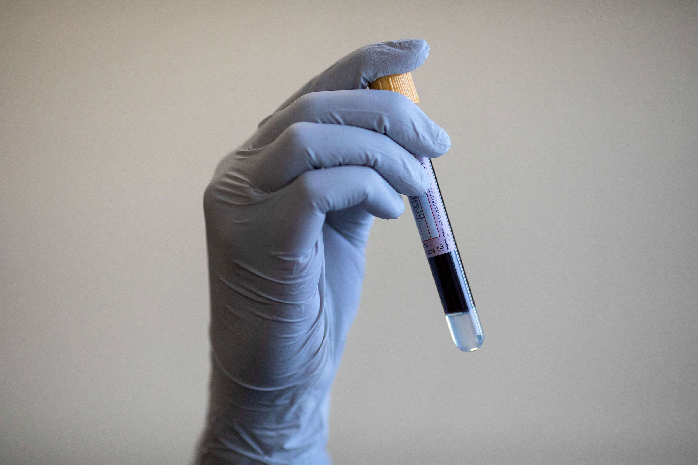 A blood sample is held during an antibody testing program at the Hollymore Ambulance Hub of the West Midlands Ambulance Service in Birmingham, Britain, on June 5, 2020. (Simon Dawson—EPA-EFE/Shutterstock)
