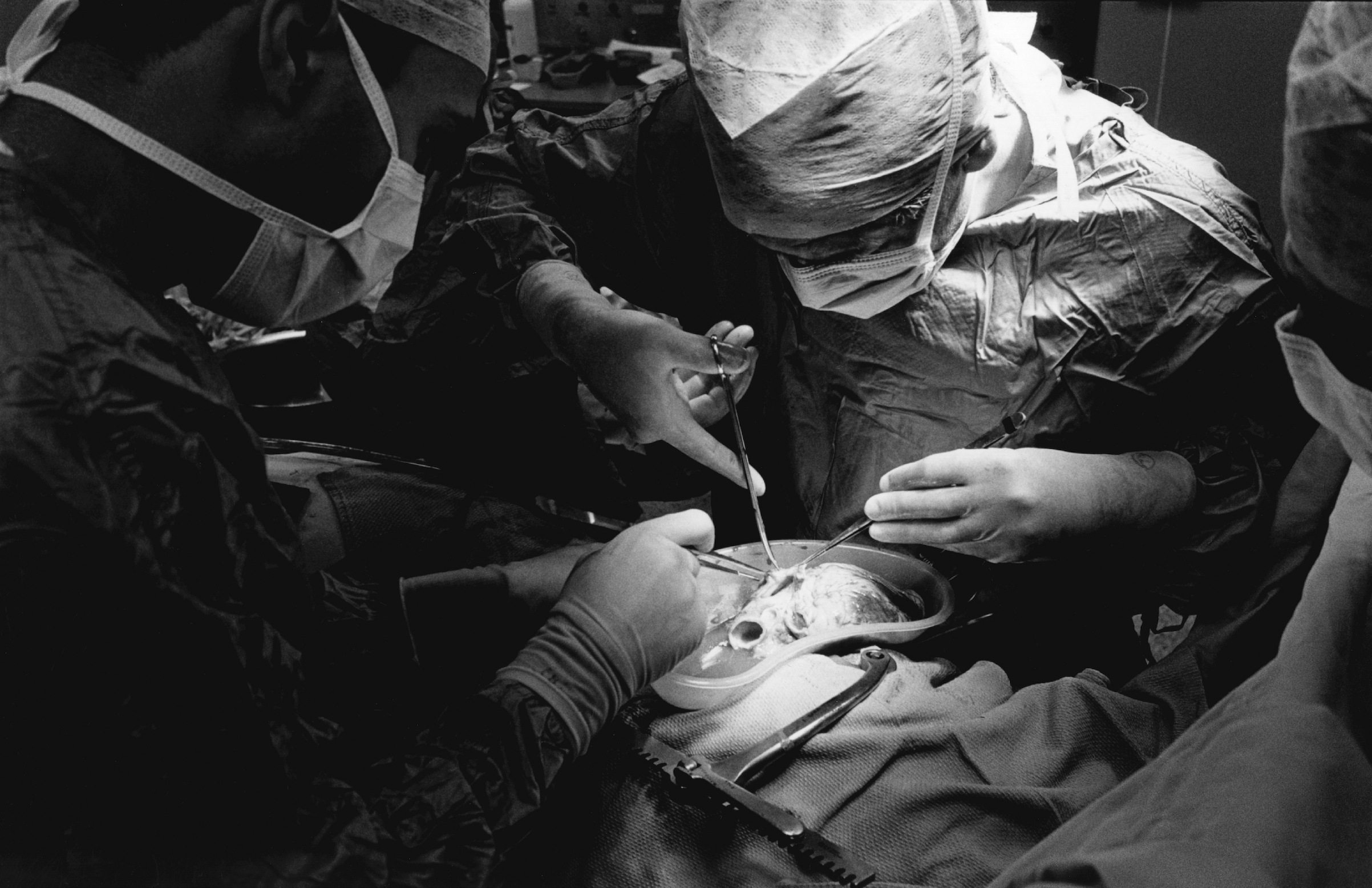 Undated photo of a heart transplant operation (Corbis via Getty Images)