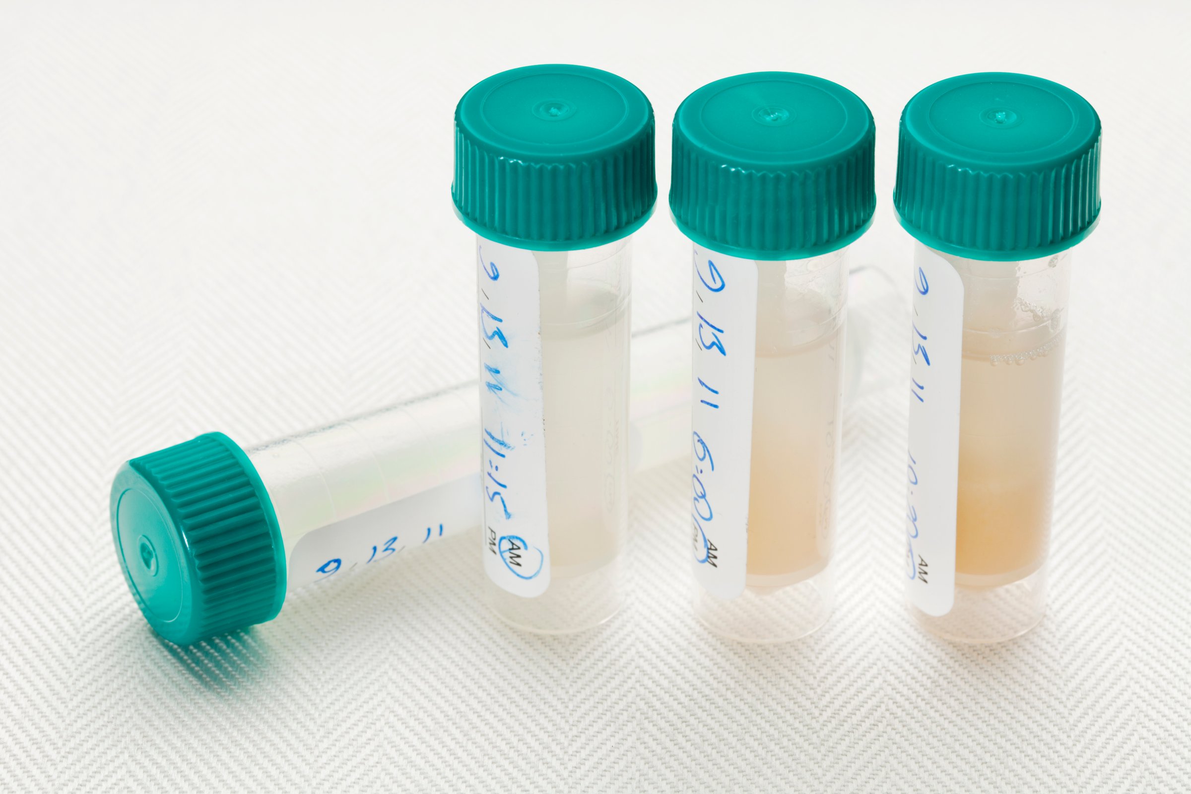 Saliva samples for laboratory test