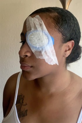 Shantania Love was hit by what she believes was a rubber bullet at a protest in Oak Park, Calif., on May 29, 2021, permanently blinding her right eye.