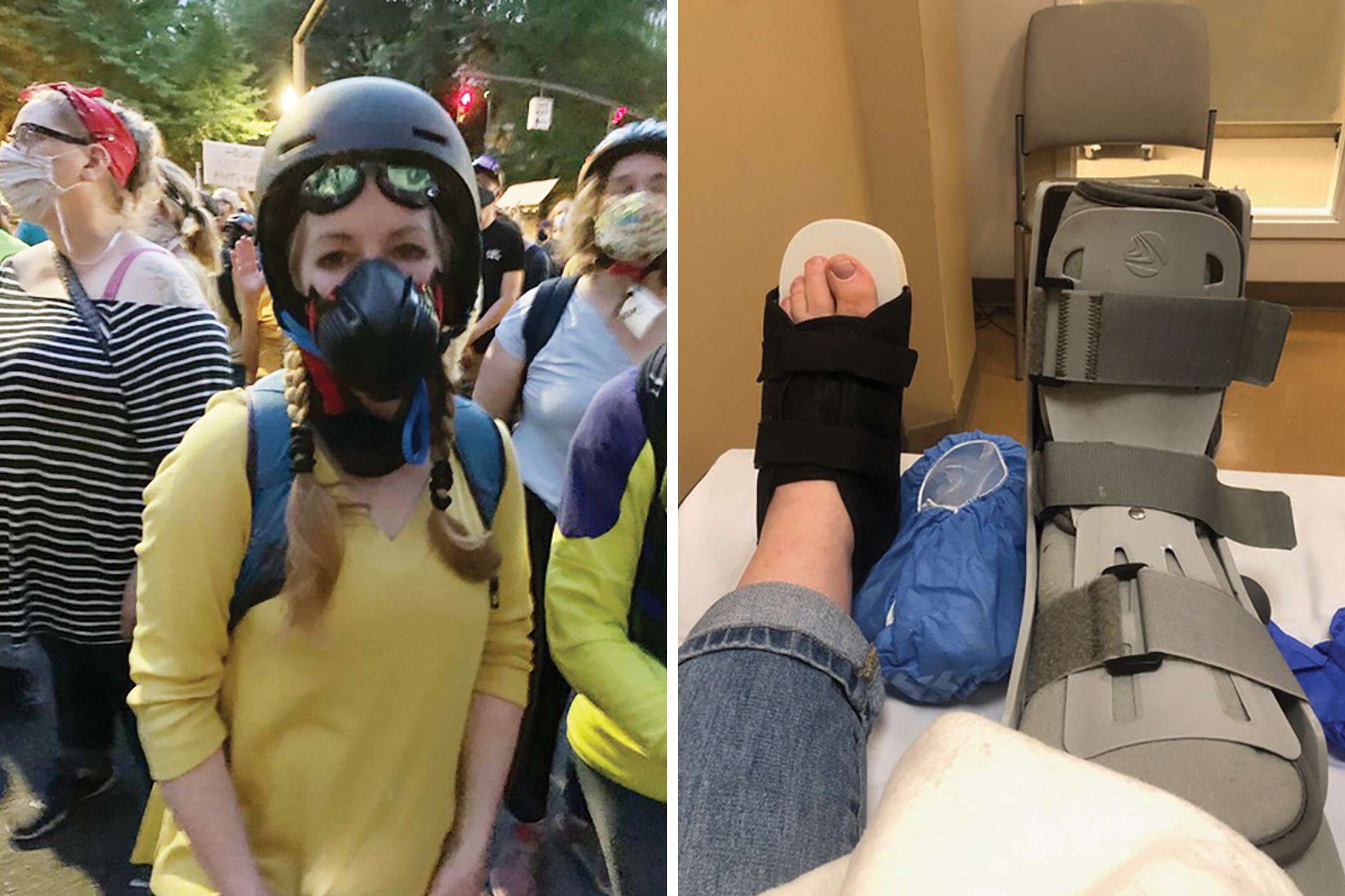 Ellen Urbani was hit in the foot by what she believes was a rubber bullet at a protest in Portland, Ore., on July 24. (Courtesy Joan Henderson-Gaither/Ellen Urbani (2))