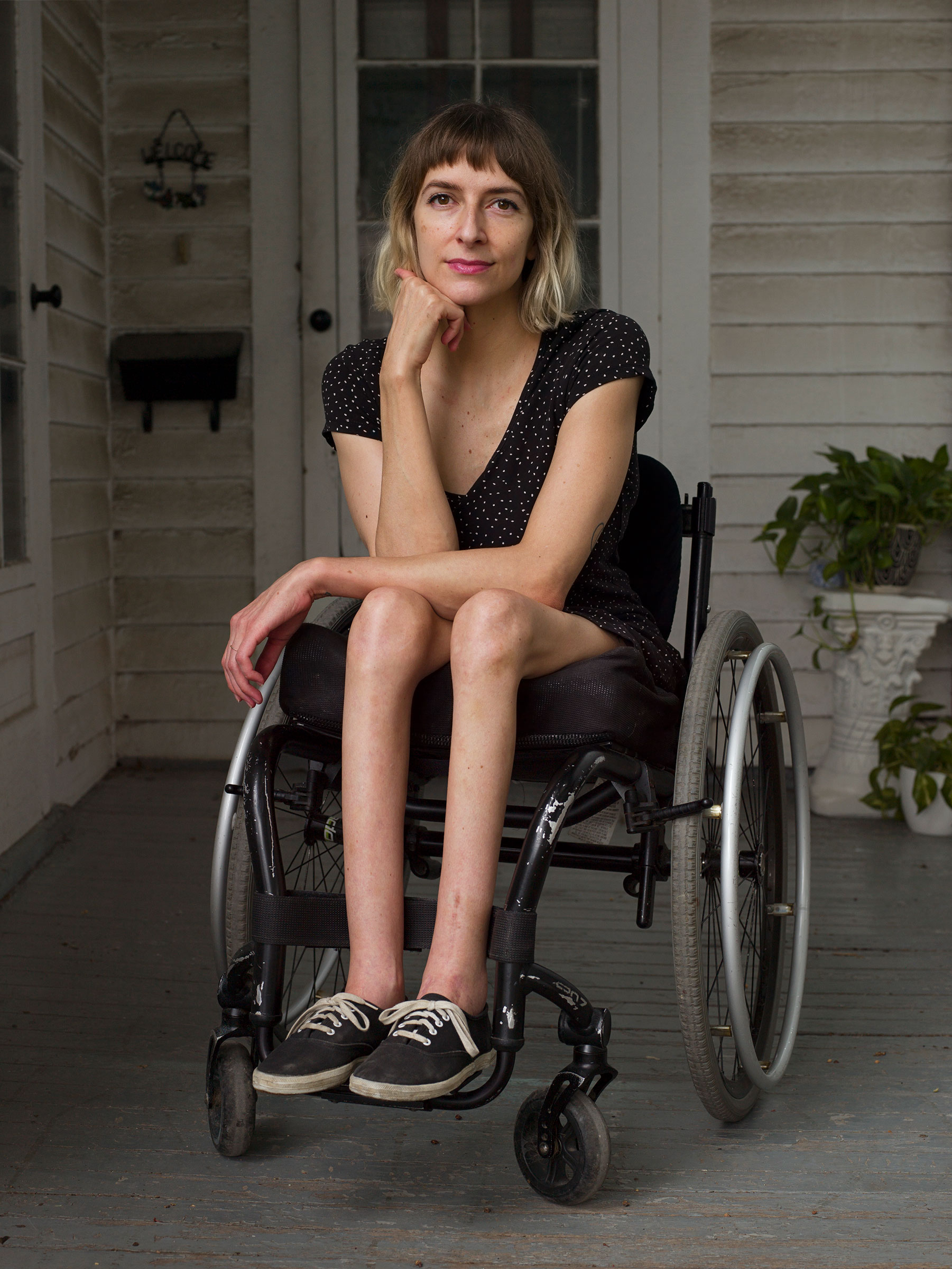 <strong>Rebekah Taussig</strong>, photographed outside her home in Kansas City, Mo., on Aug. 6. "<a href="https://time.com/5881597/disability-kindness/">What Does Kindness Look Like?</a>" Aug. 31 issue. (Jess Dugan for TIME)
