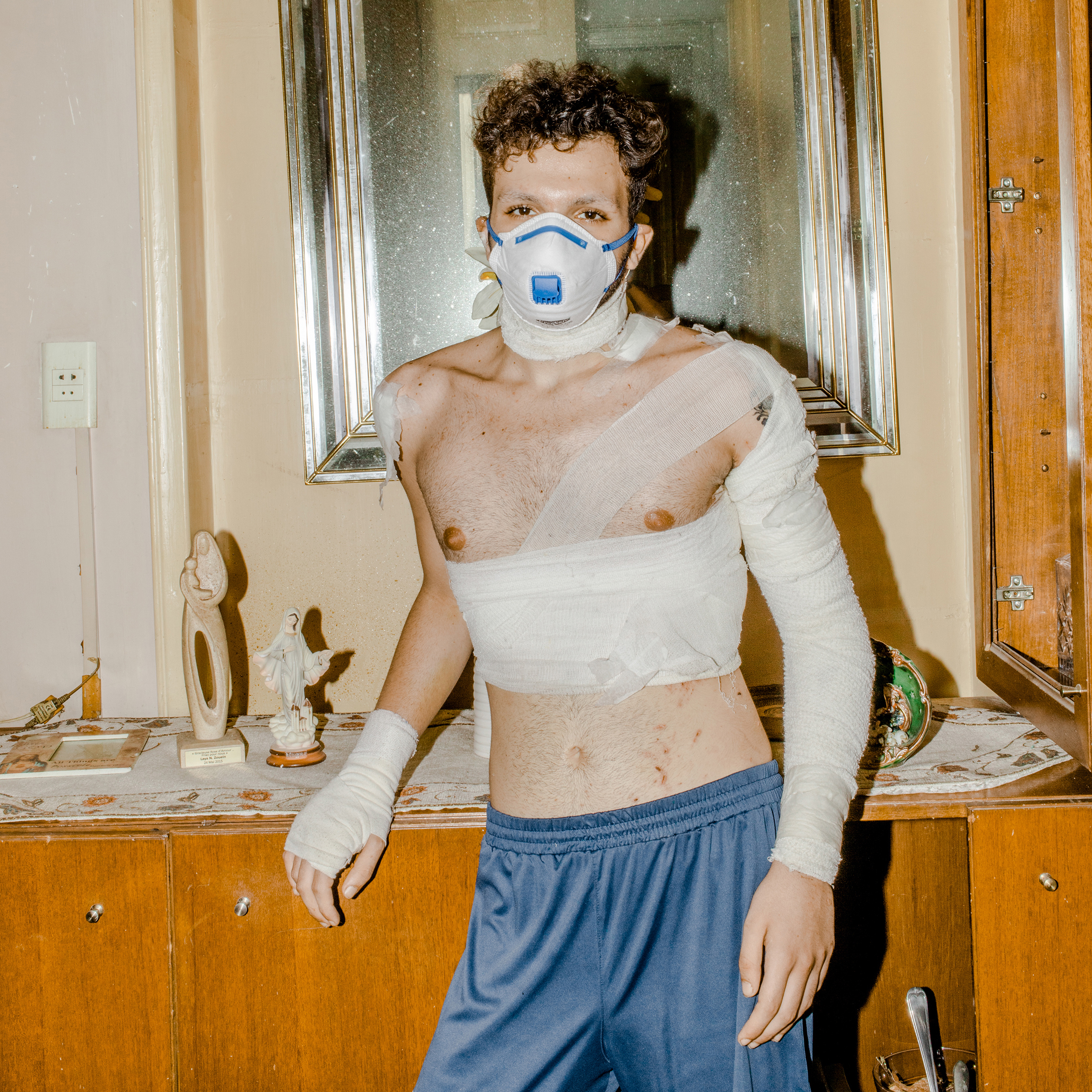 <strong> Andrea</strong>, a drag performer in Beirut who was injured in the Aug. 4 port blast. "<a href="https://time.com/5879192/beirut-explosion-lebanon-reform/">After the Explosion</a>," Aug. 31 issue. (Myriam Boulos for TIME)