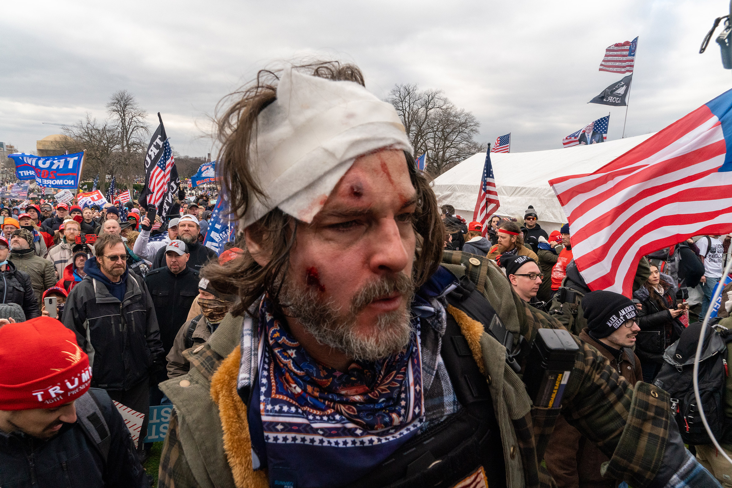 An injured pro-Trump supporter outside the Capitol building after clashes with police and security forces in Washington D.C., on Jan. 6.