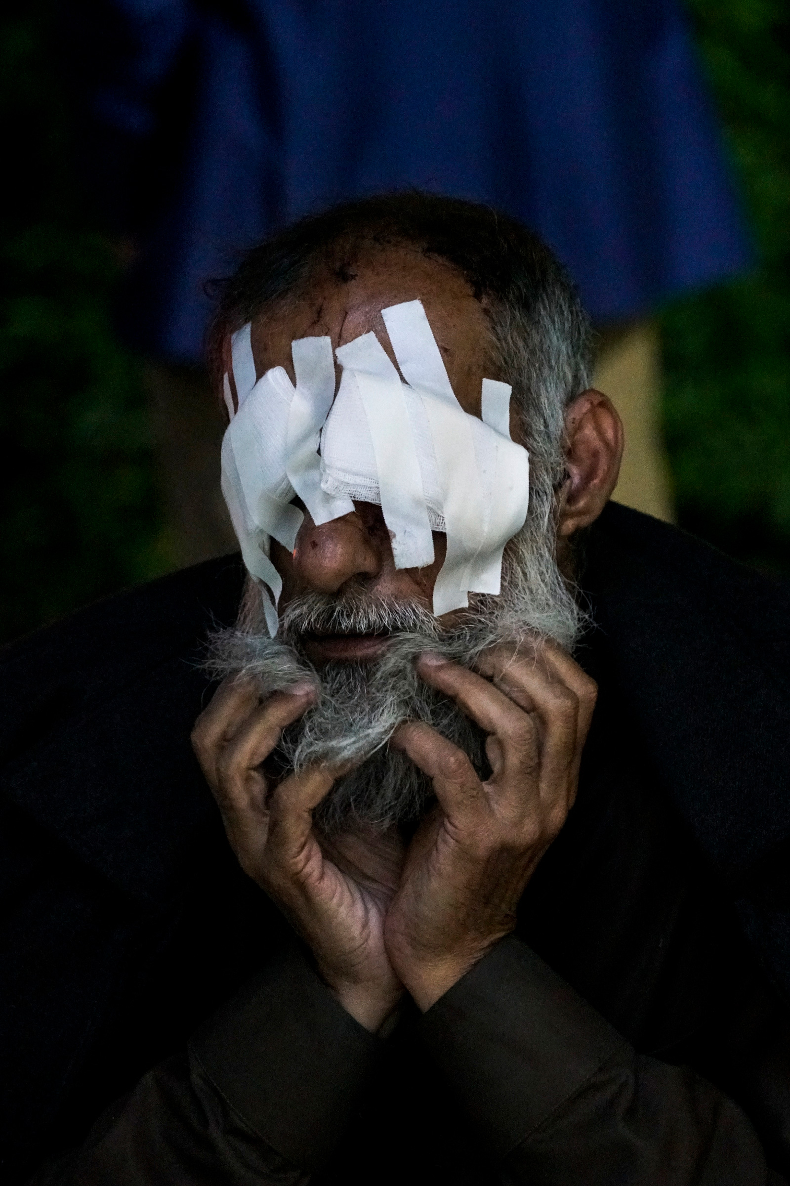 Adnan Thanon Younis, 53, was blinded by an exploding shell in Mosul and permanently lost his vision. It is estimated that 9,000–11,000 Iraqi civilians were killed in the battle of Mosul. Erbil, Iraq, 2017.
