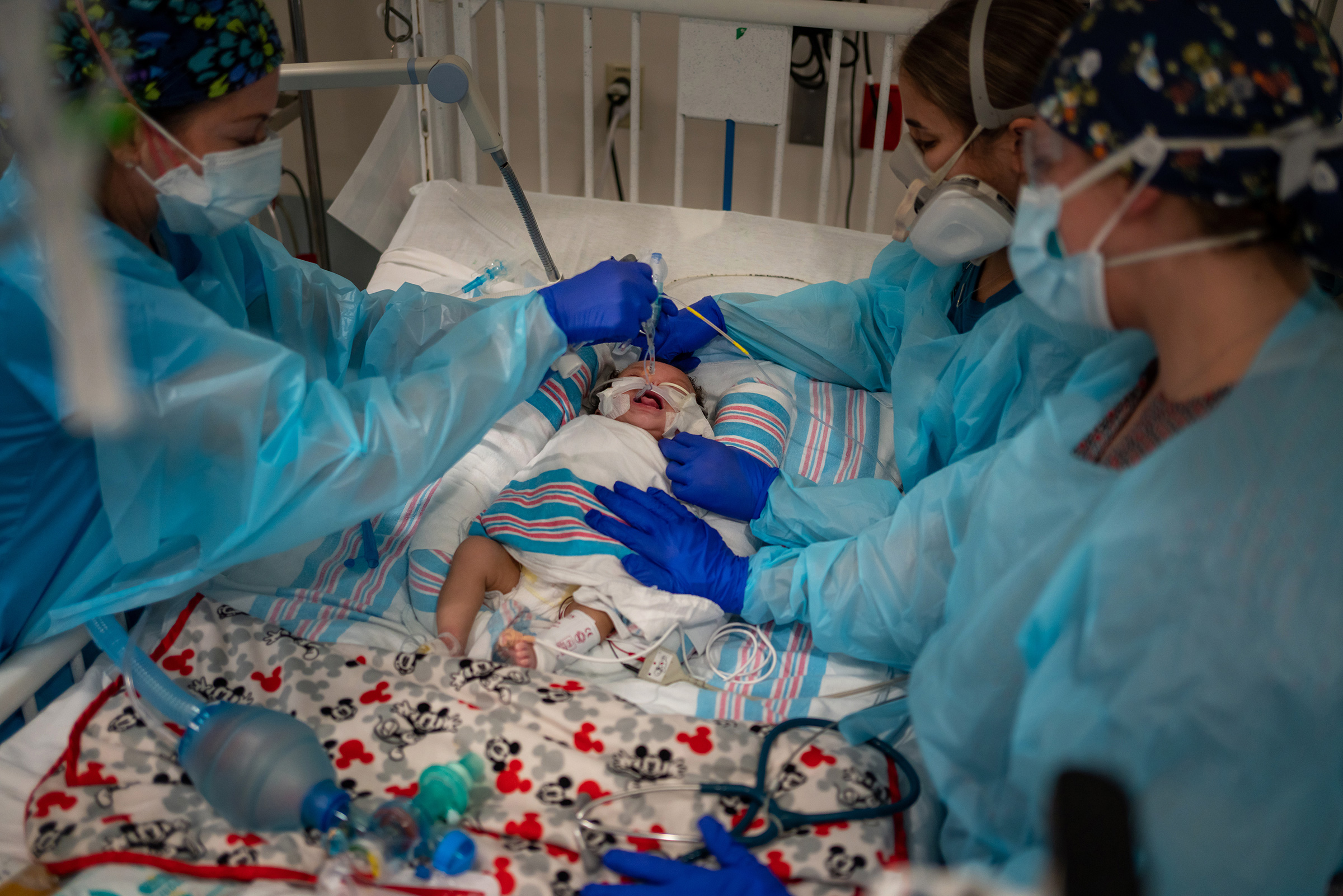 Two-month-old Carvase Perrilloux undergoes an extubation procedure, taking him off of the ventilator that has been keeping him alive. (Kathleen Flynn for TIME)