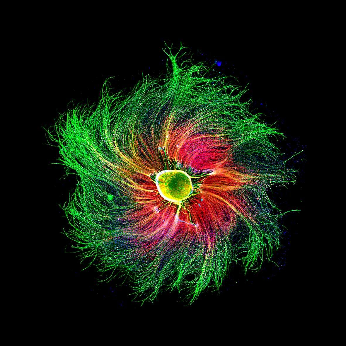 Sensory neuron from an embryonic rat (Paula Diaz—Courtesy of Nikon Small World)