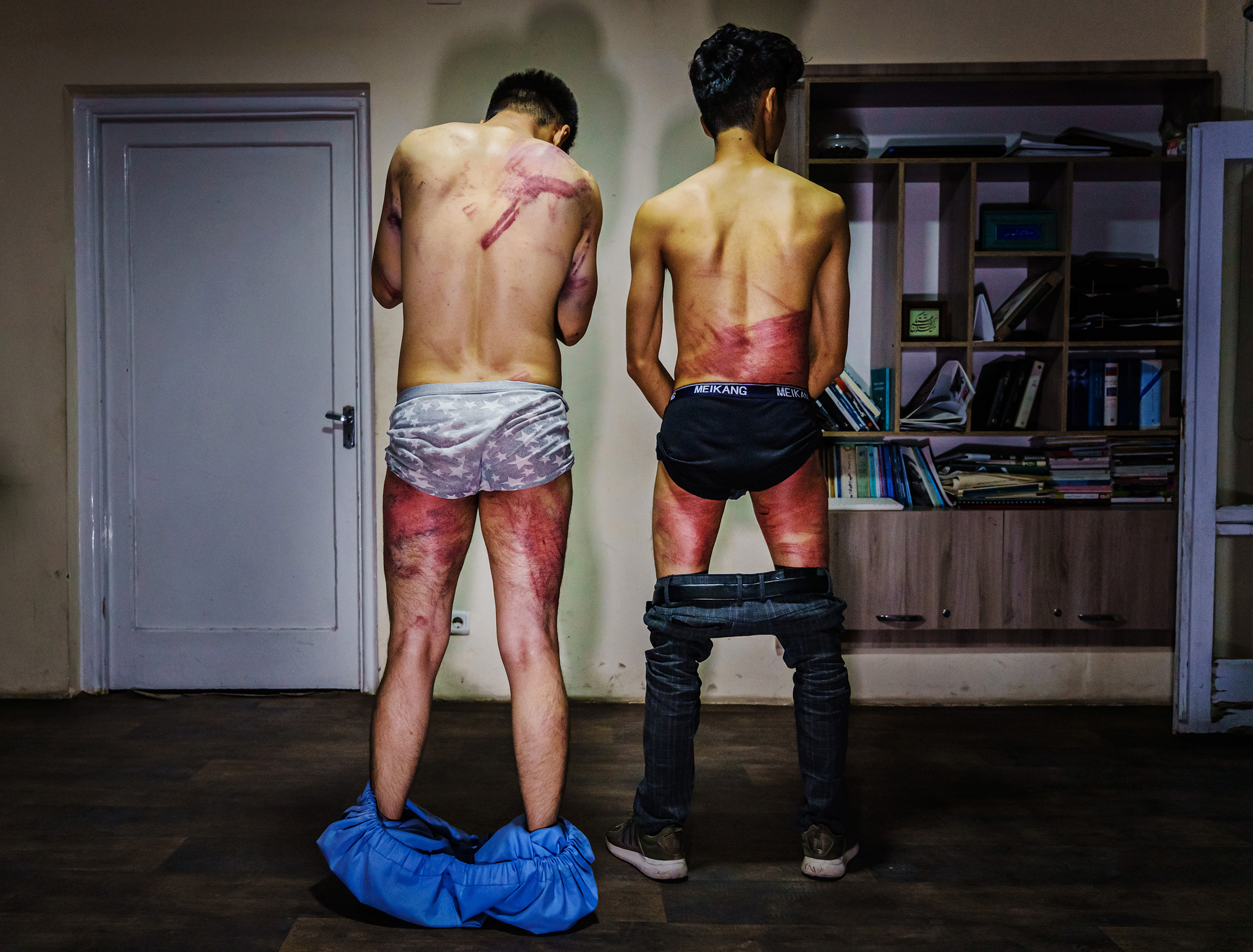 Journalists from the Etilaatroz newspaper, Nemat Naqdi, 28, left and Taqi Daryabi, 22, undress to <a href="https://www.latimes.com/world-nation/story/2021-09-08/women-protest-against-taliban-responds-with-force">show their wounds</a> after they were arrested, tortured and beaten by Taliban fighters for reporting on a women's rights protest, in Kabul on Sept. 8. (Marcus Yam—Los Angeles Times/Getty Images)