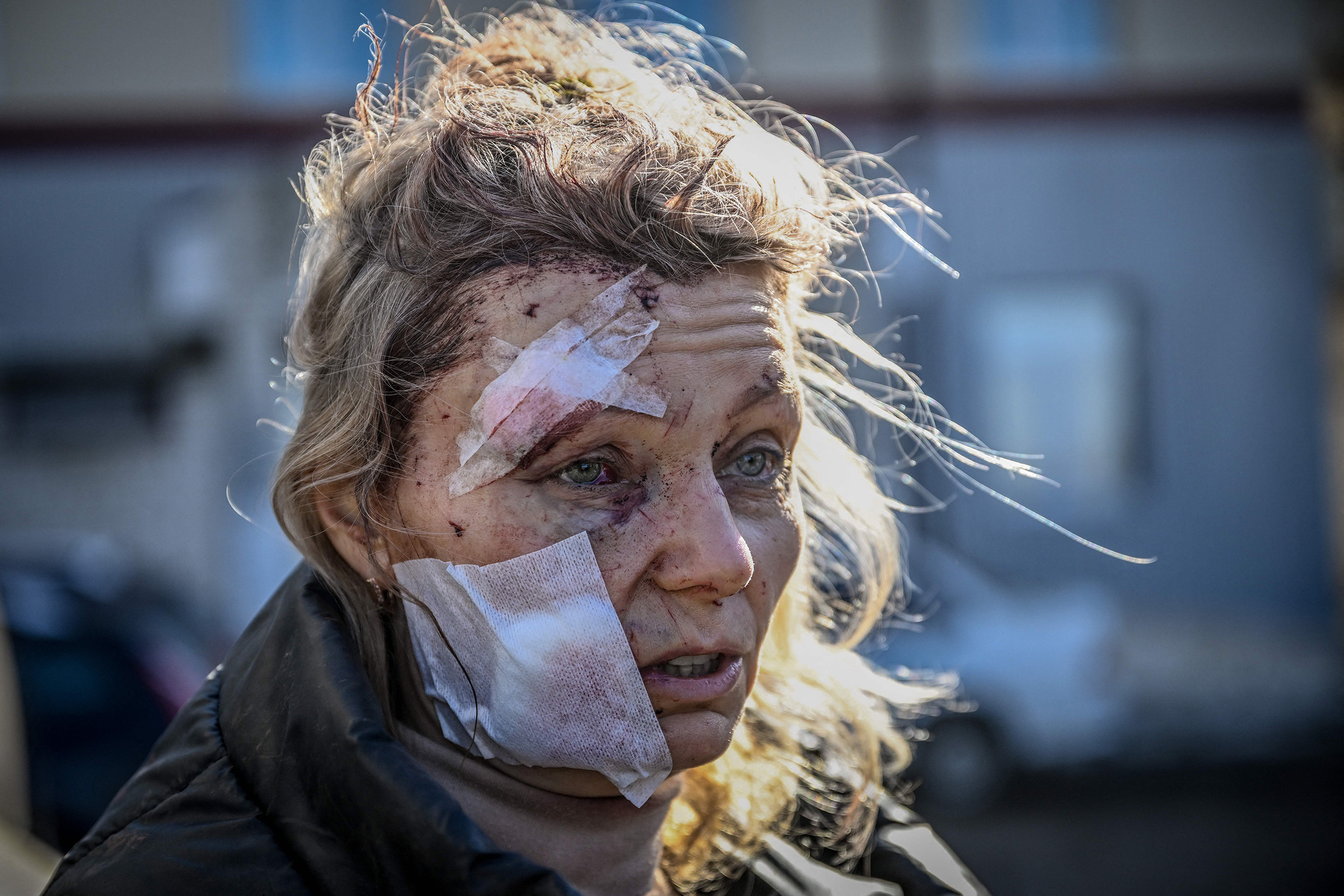 A wounded woman stands outside a hospital after a bombing in Chuguiv in eastern Ukraine, by Russian forces, on Feb. 24.