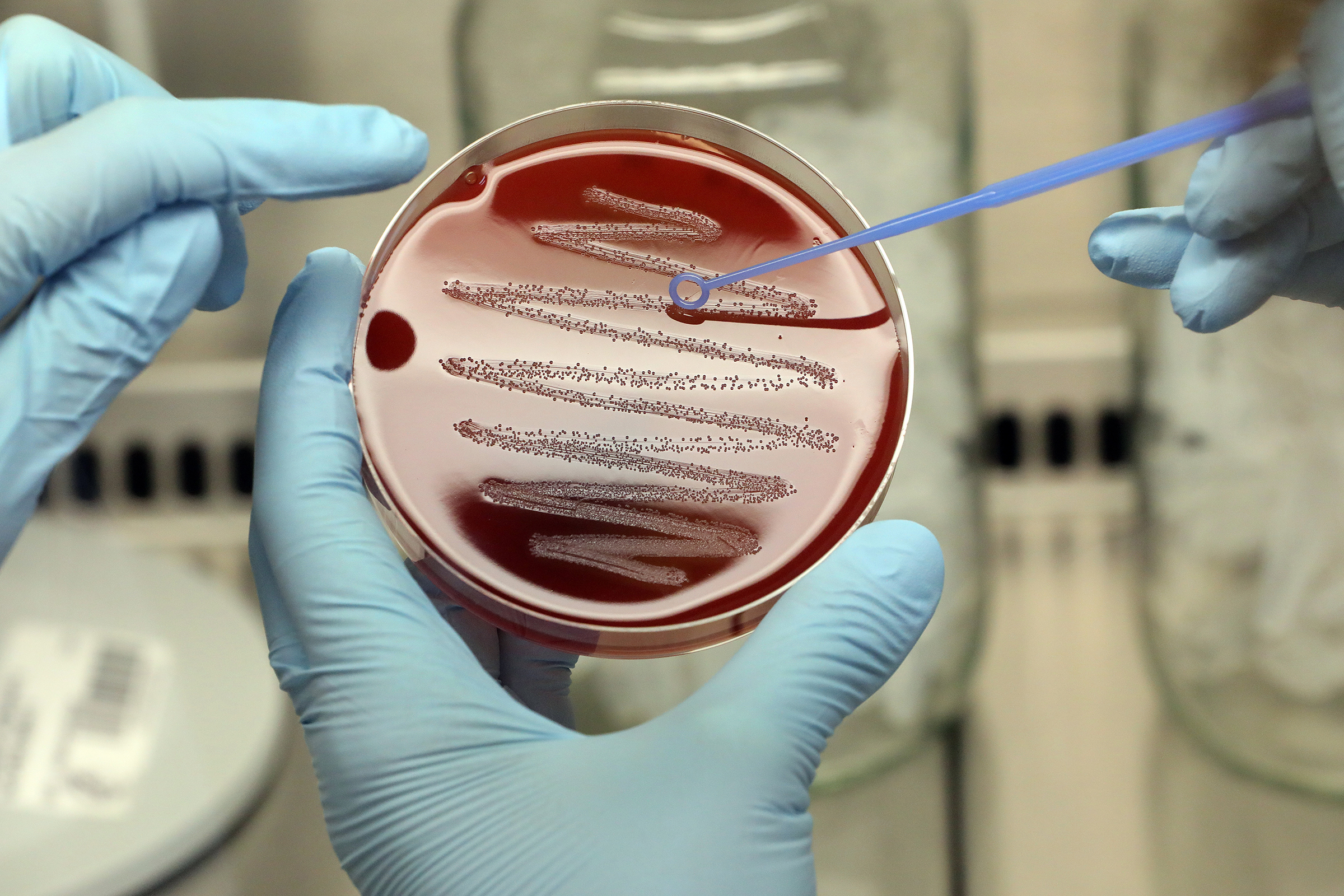 A microbiologist at the Max-Planck-Institute for Infection Biology prepares a bacterial colony of the strain Streptococcus pyogenes on a blood agar plate. Current research focuses on finding regulatory mechanisms for infection and immunity in bacteria. Scientists are especially interested in the role of RNA and certain proteins that control cellular processes. The goal is to incorporate these findings into new medical advancements, as is the case with CRISPR-Cas9. (Wolfgang Kumm—dpa/Getty Images)