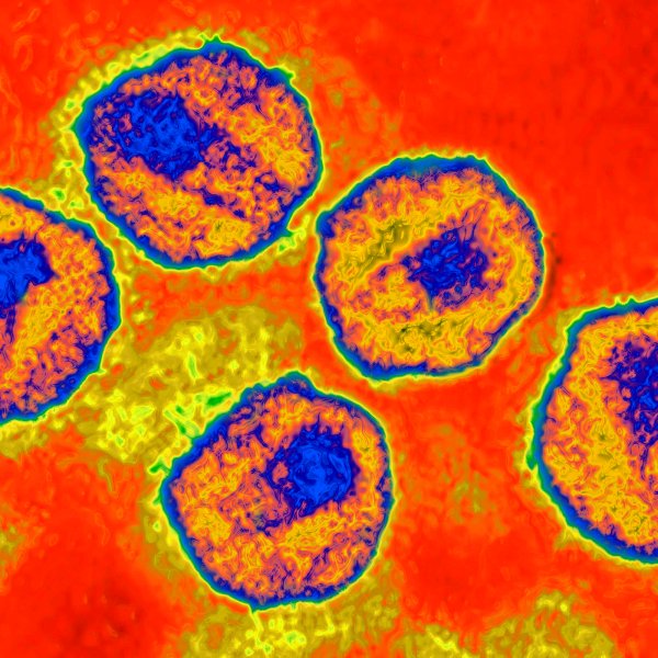 HIV virus. Image produced from an image taken with transmission electron microscopy. Viral diameter around 110 to 125 nm.