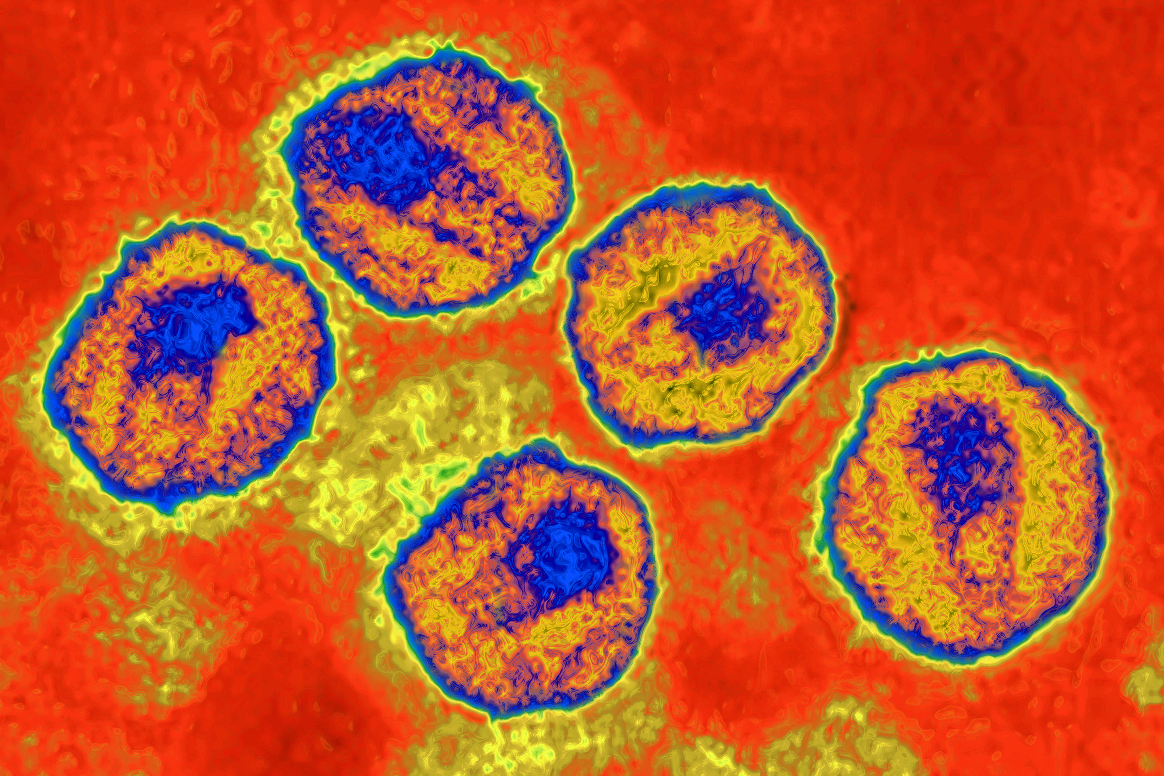 HIV virus. Image produced from an image taken with transmission electron microscopy. Viral diameter around 110 to 125 nm. (BSIP/Universal Images)