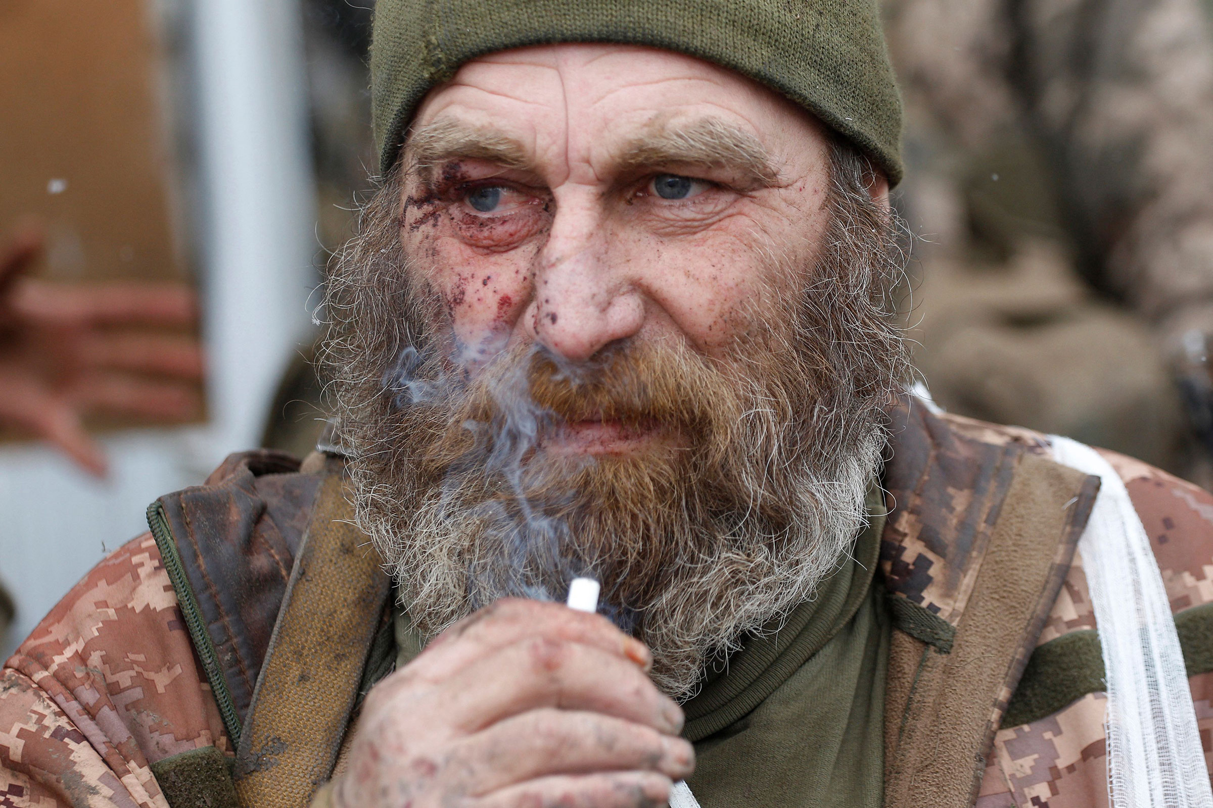 A wounded serviceman of the Ukrainian Military Forces smokes after a battle with Russian troops and Russia-backed separatists in Lugansk region on March 8. (Anatolii Stepanov—AFP/Getty Images)