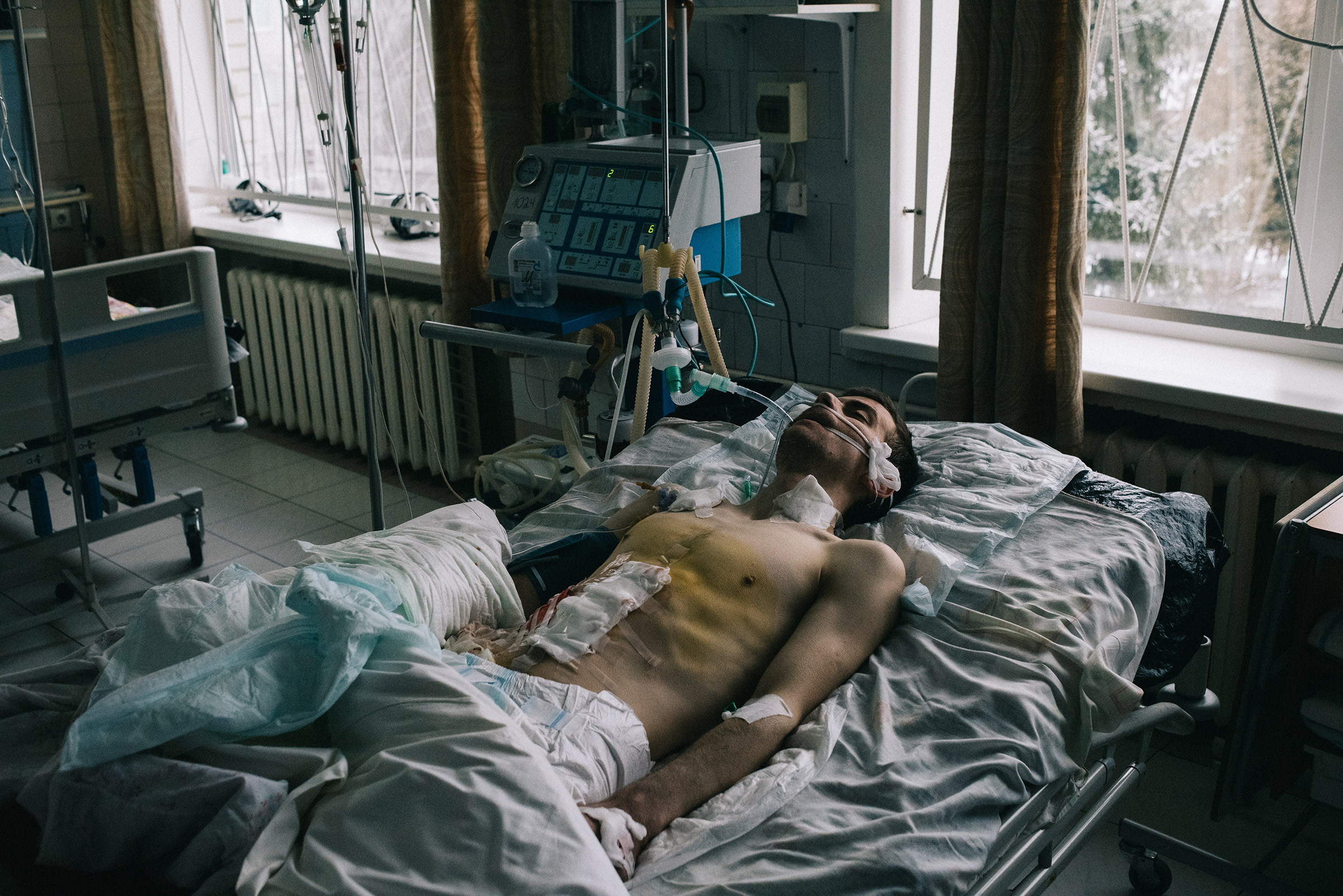 Yaroslav , 31, reanimation, territory defence. The wounded fighters of the territorial defense who fell under the aircraft and other bombing of the military unit are in the treatment of Brovary City Hospital. 01.03.2022, Brovary, Kyiv district
