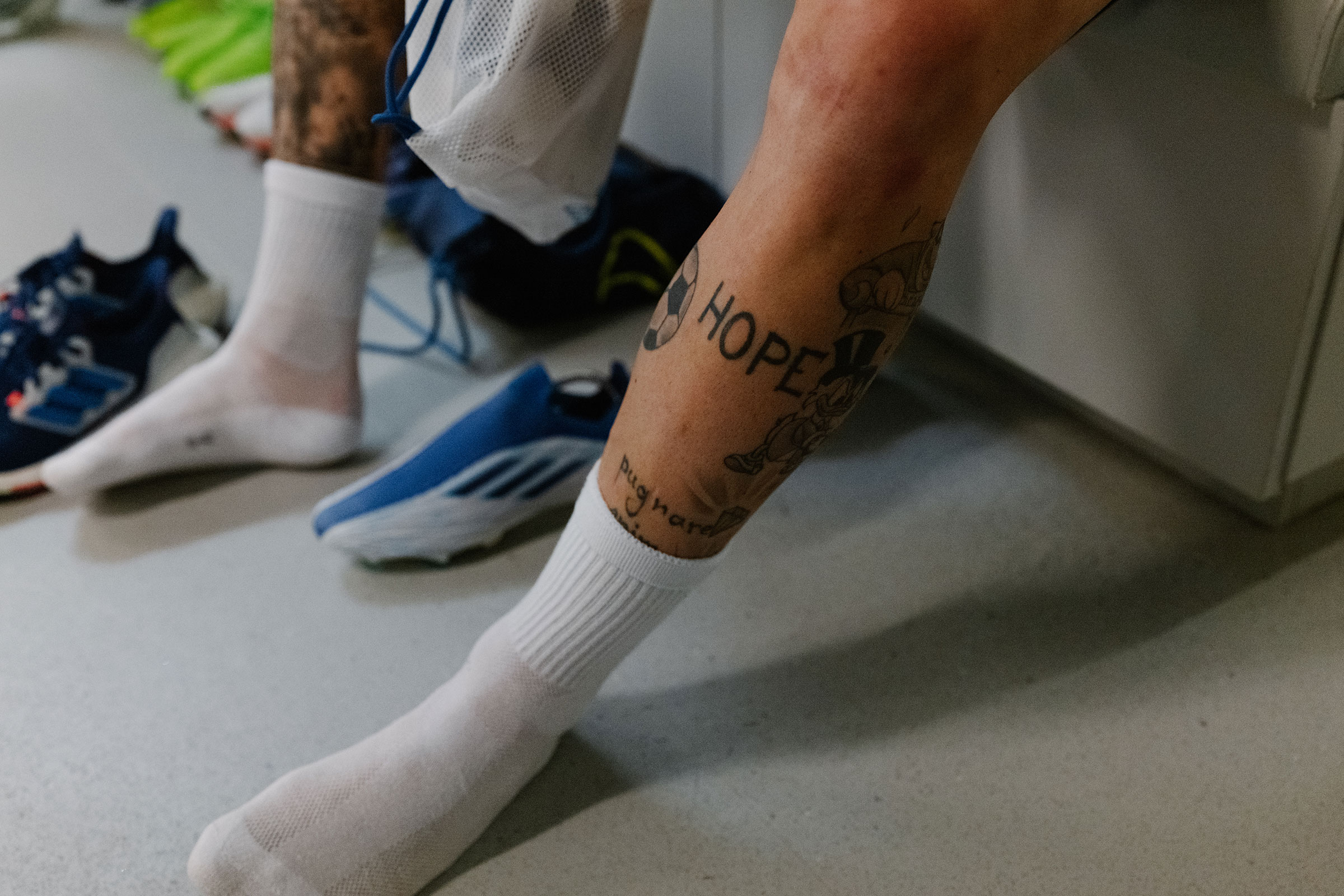 Mykola Shaparenko's "HOPE" tattoo (Ciril Jazbec for TIME)