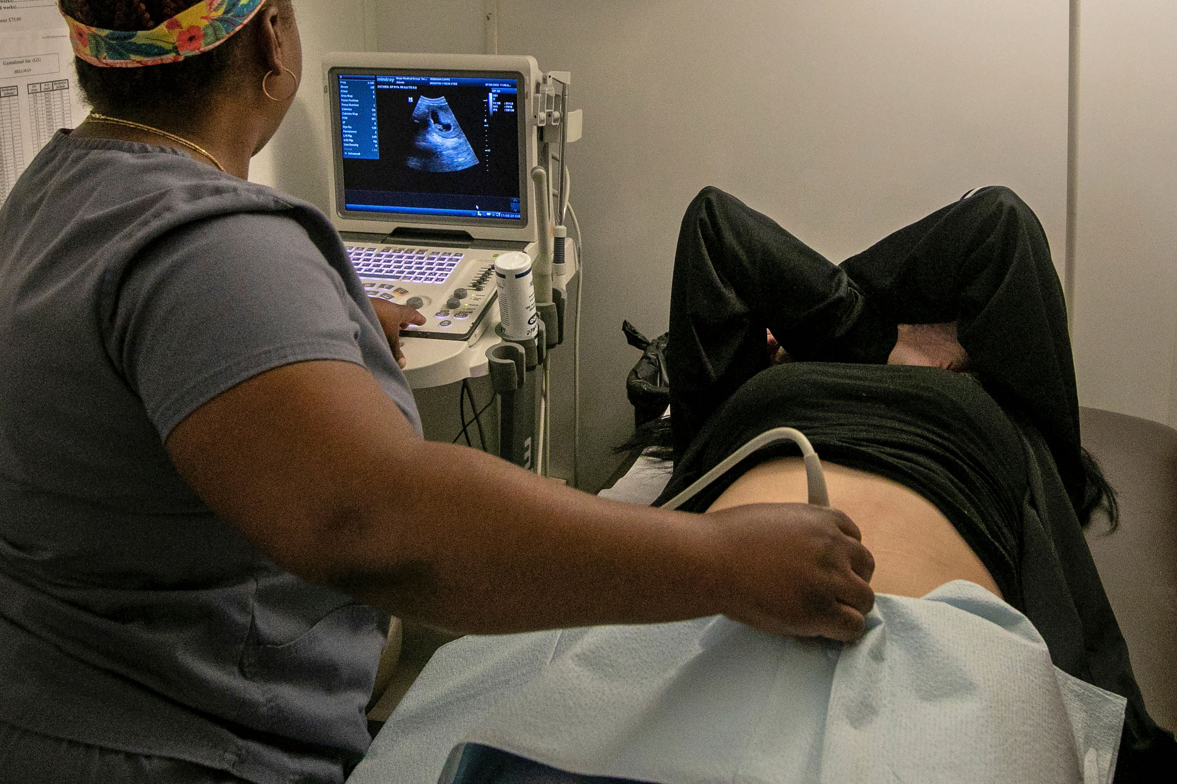 An operating room technician performs an ultrasound on a patient at an abortion clinic in Shreveport, La., Wednesday, July 6, 2022.