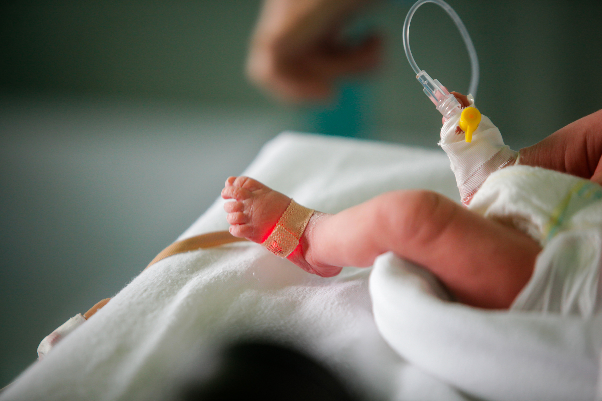 A preterm baby in an incubator in the neonatal section of a hospital. (George Calin—Getty Images)