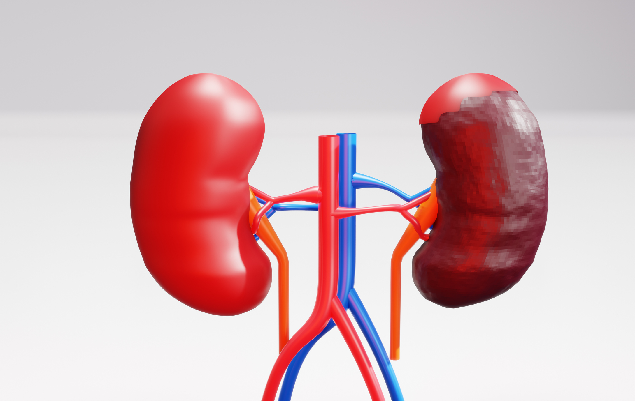human kidneys disease anatomy outside 3d rendering image Concept of urinary system image