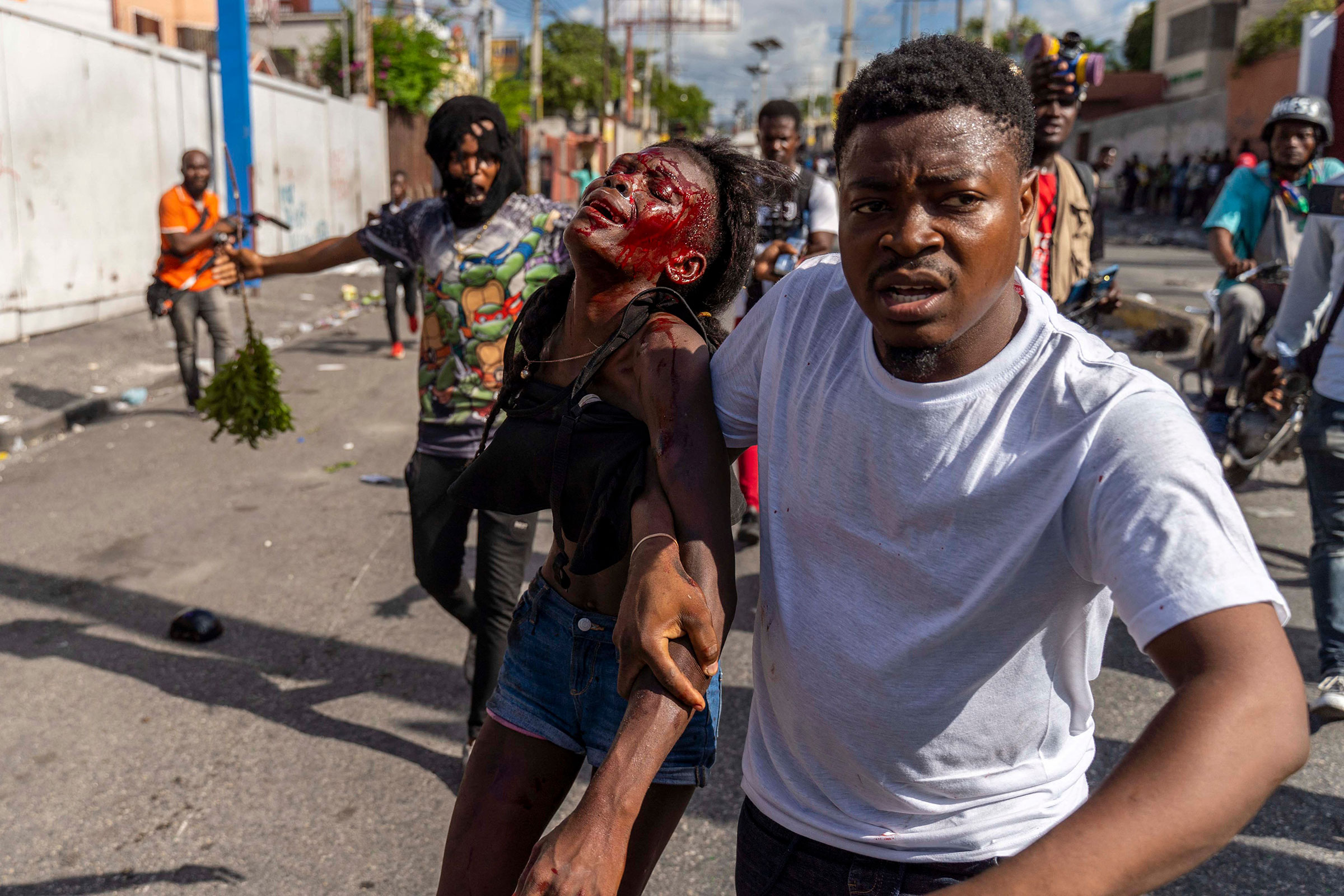 A man assists an injured woman during a protest against Haitian Prime Minister Ariel Henry calling for his resignation, in Port-au-Prince, Haiti, on Oct. 10.