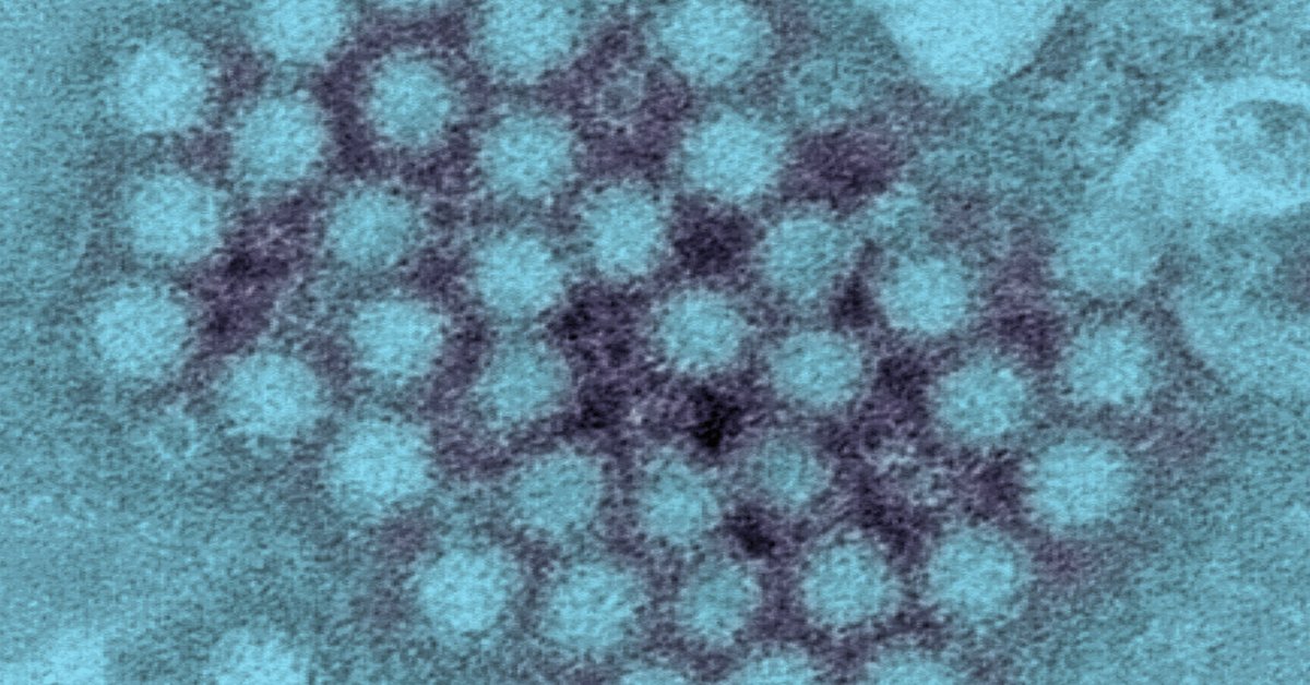 What to Know About Norovirus and How to Treat It