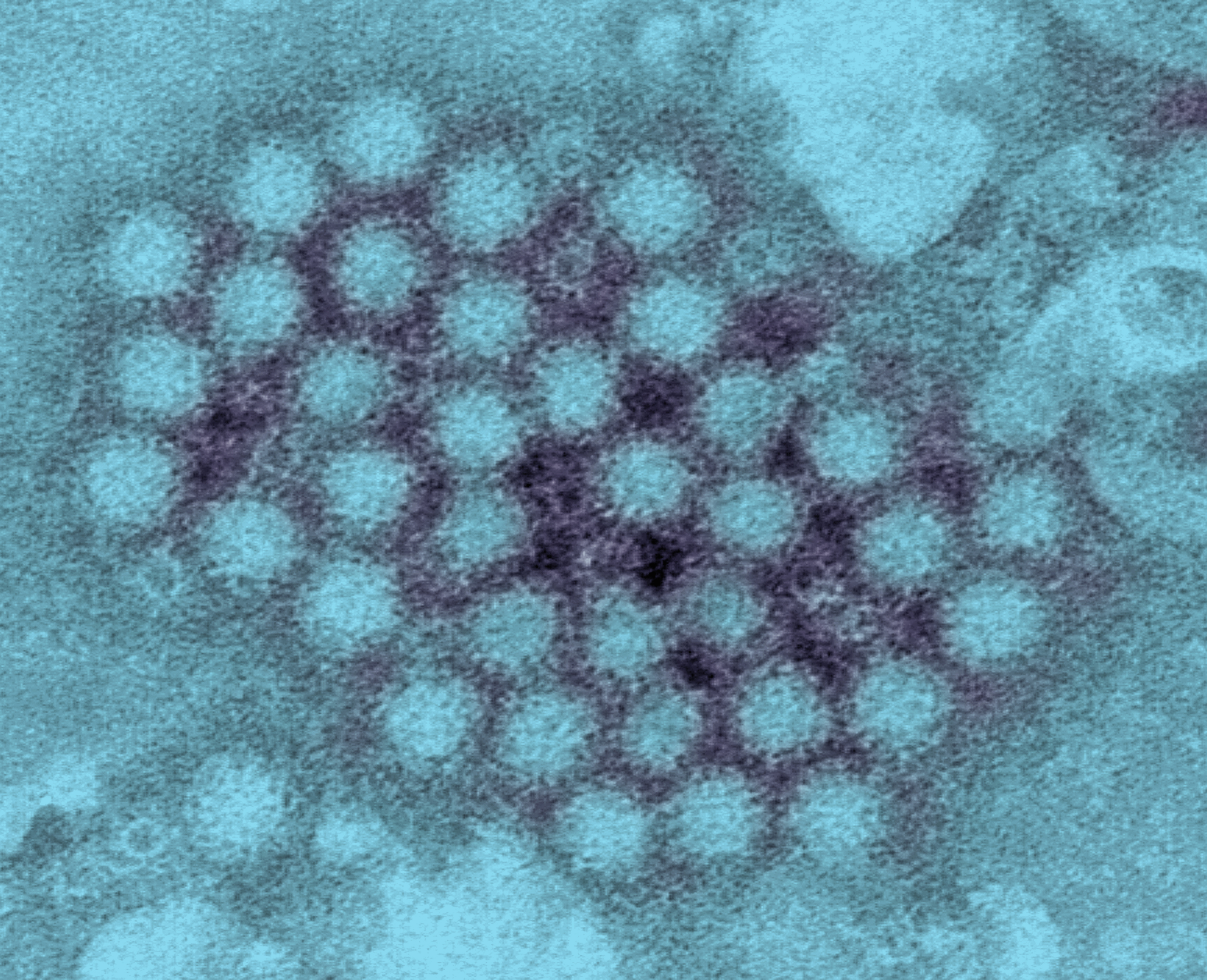 Transmission electron micrograph (TEM) of norovirus virions (Scott Camazine—Getty Images)