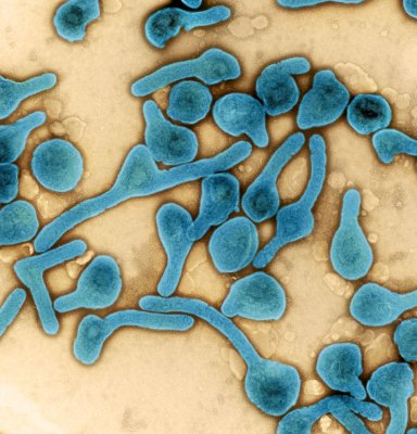 Deadly Marburg Virus Spreads to Tanzania for the First Time
