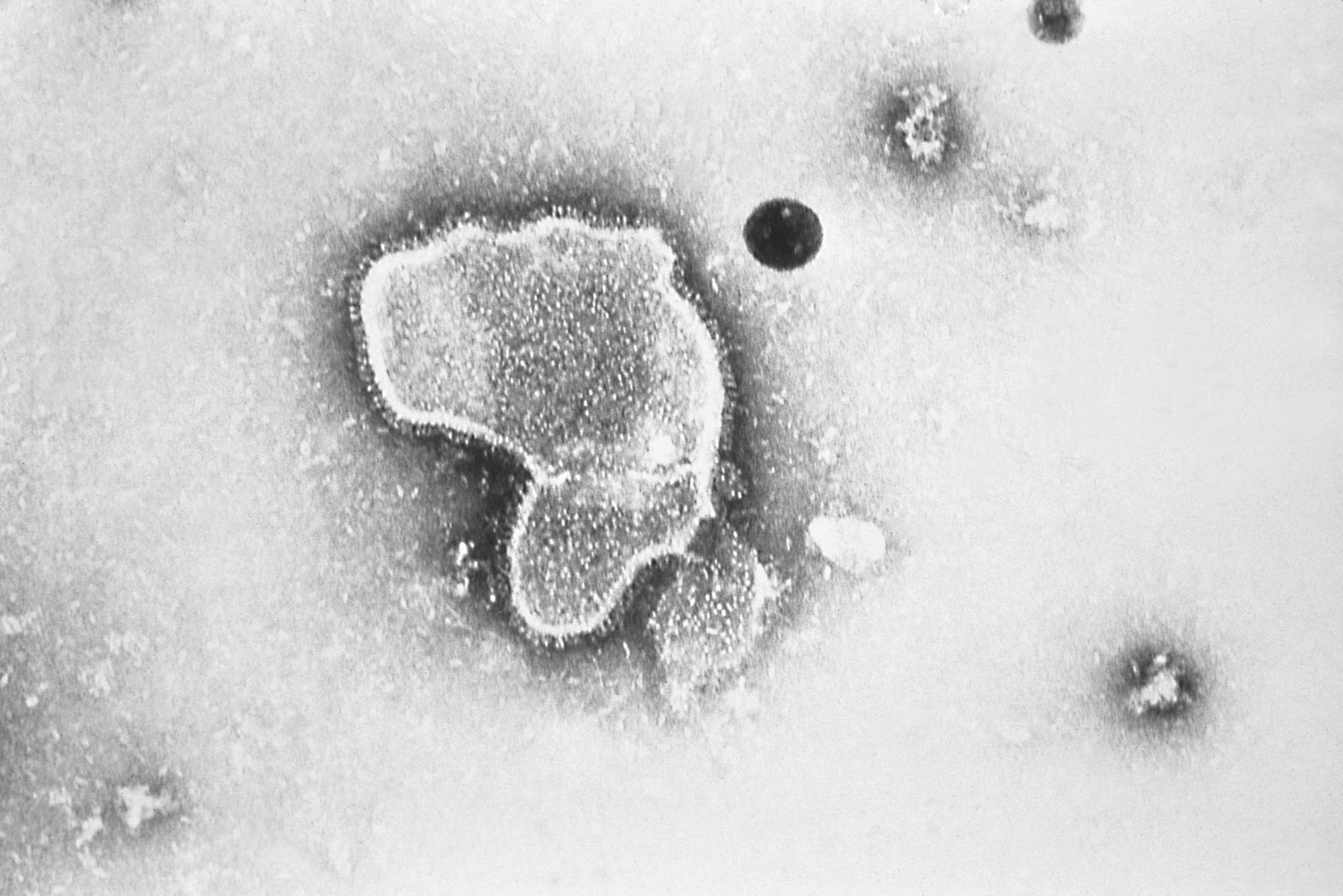 This 1981 electron microscope image provided by the Centers for Disease Control and Prevention shows a human respiratory syncytial virus, also known as RSV. (CDC via AP)