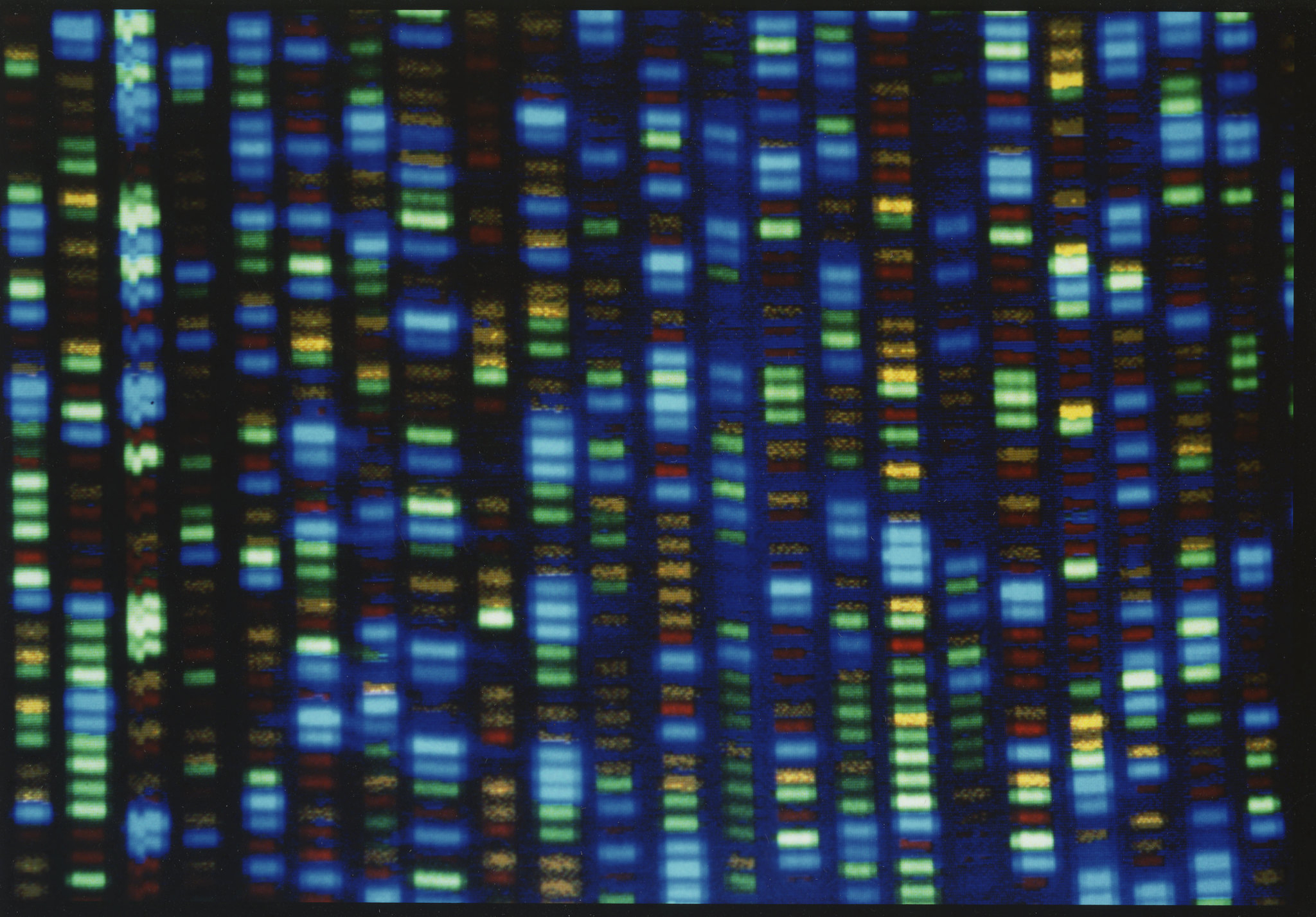 This undated image made available by the National Human Genome Research Institute shows the output from a DNA sequencer. (NHGRI—AP)