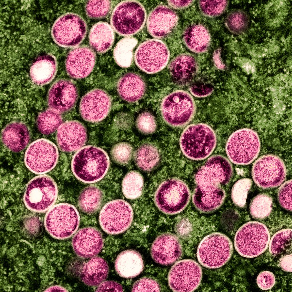 Colorized transmission electron micrograph of mpox particles (pink) found within an infected cell (green), cultured in the laboratory. (NIH-NIAID/IMAGE POINT FR/BSIP/Universal Images Group/Getty Images)