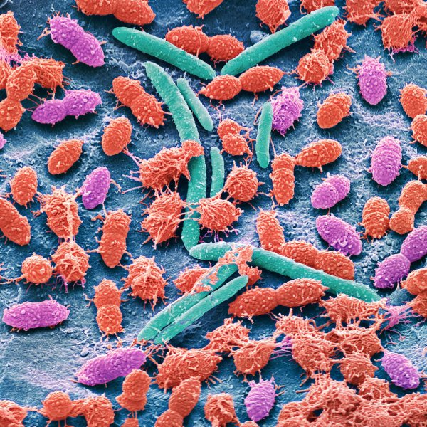Scanning electron micrograph (SEM) of bacteria cultured from a sample of human feces.