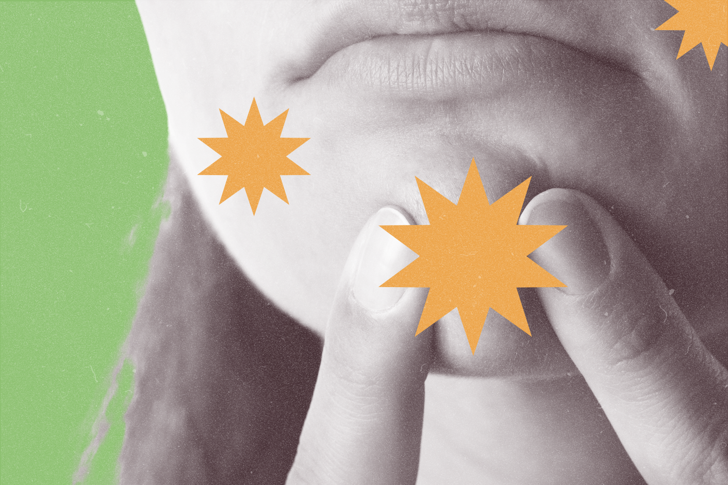 Why Is It So Bad To Pop A Pimple?